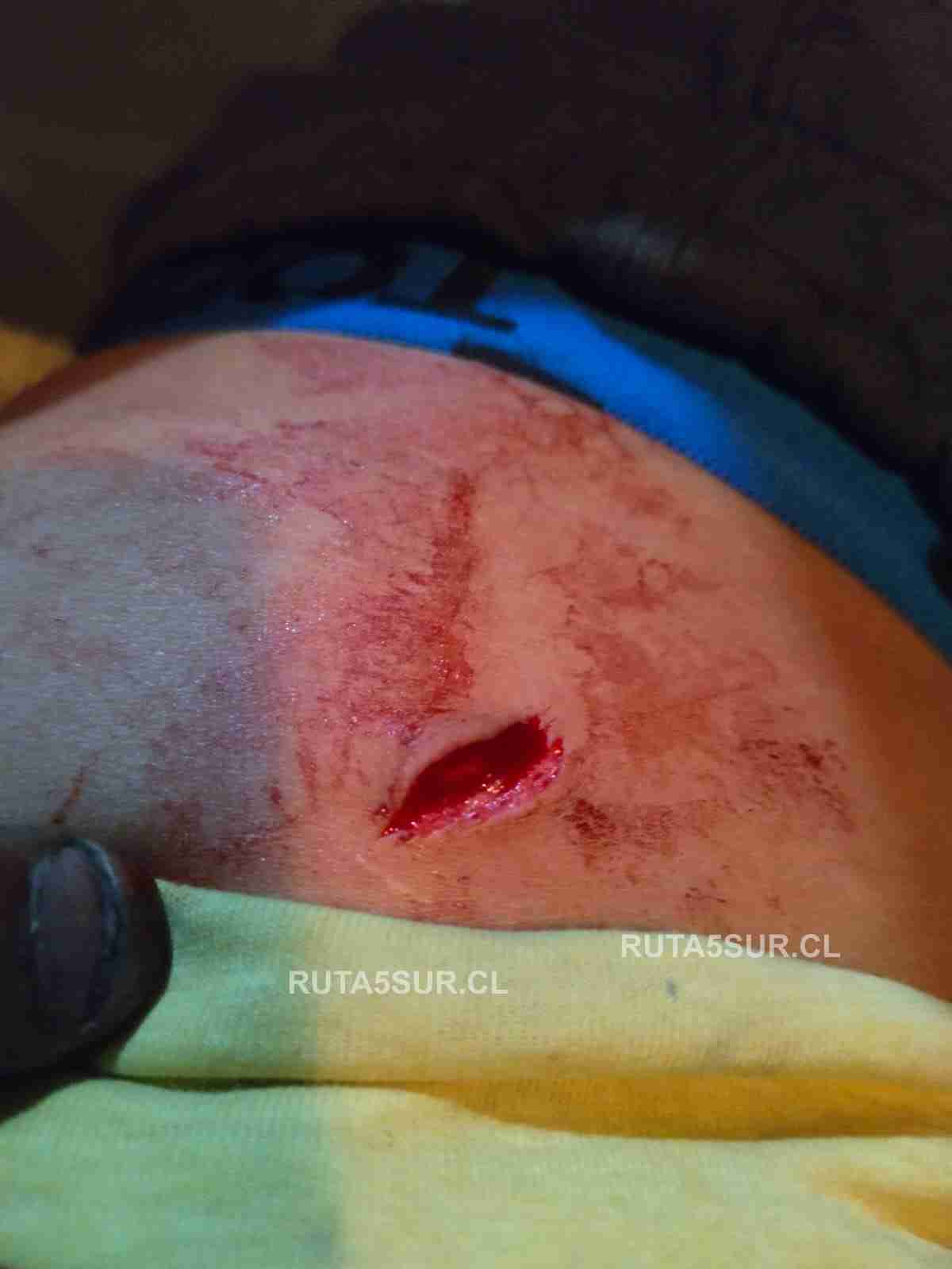 Reporte en vivo Ruta 5 Sur