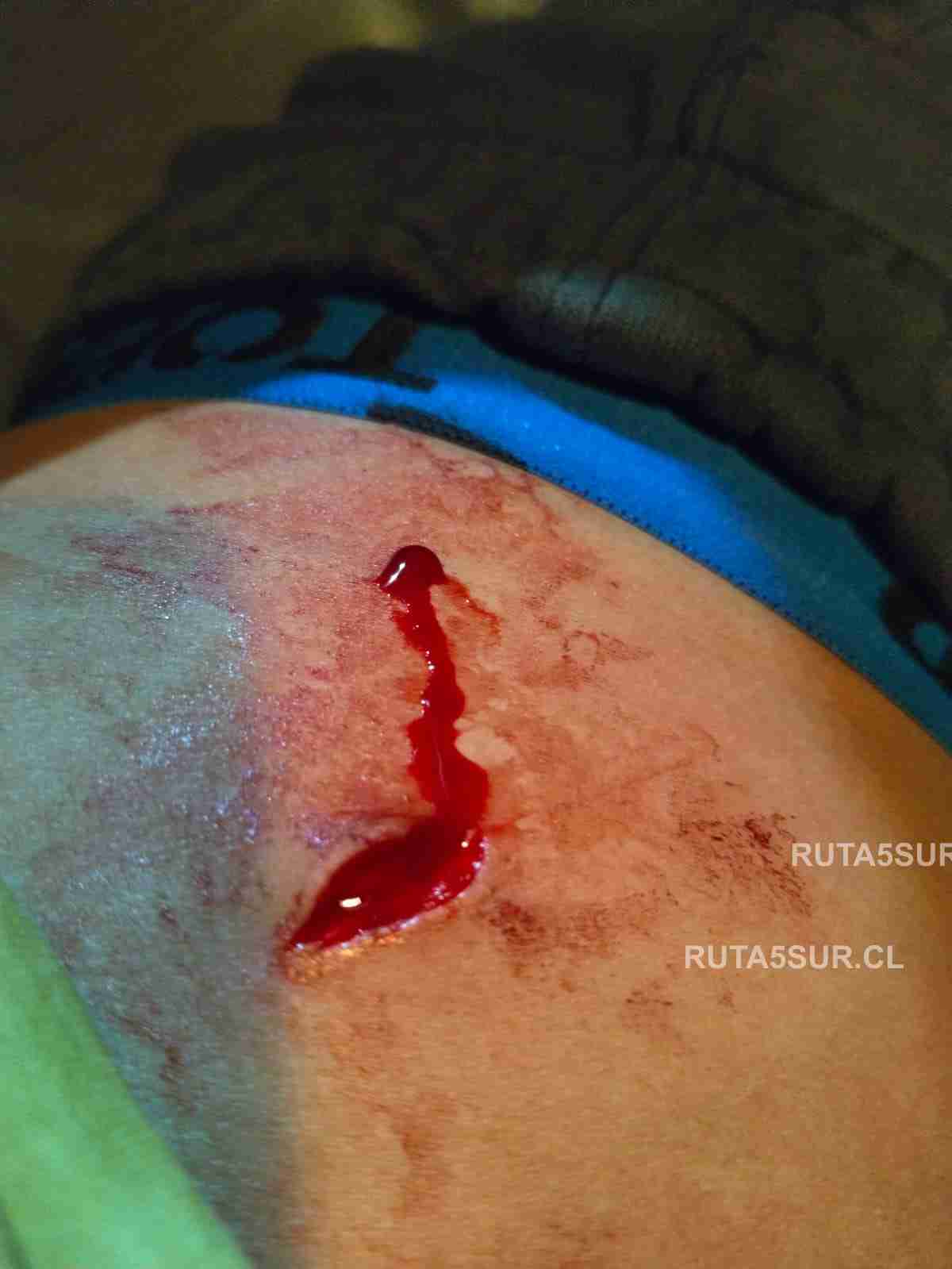 Reporte en vivo Ruta 5 Sur