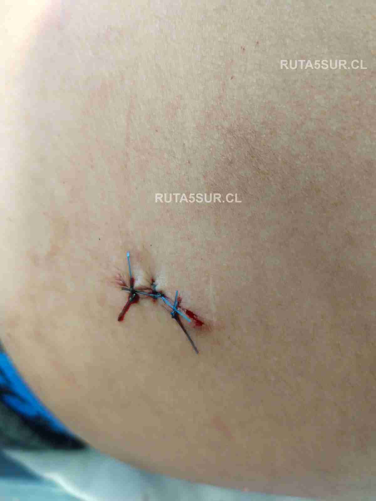 Reporte en vivo Ruta 5 Sur